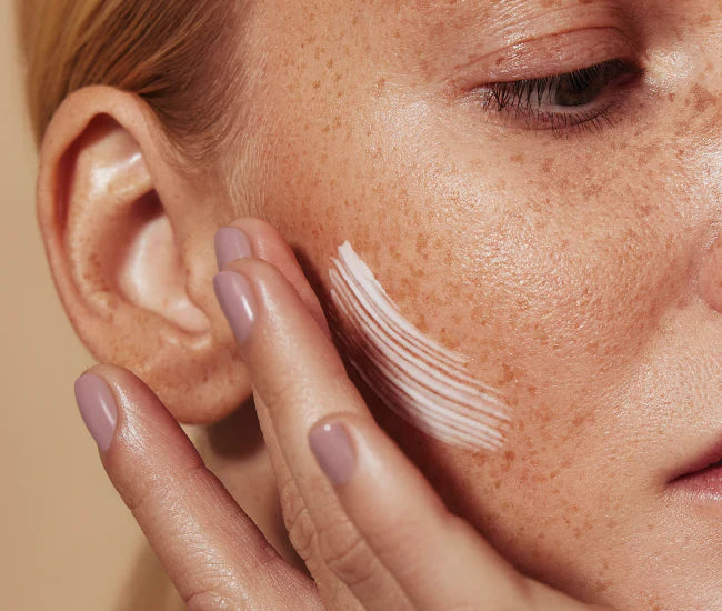 After-Sun Care: Why It Matters Even Without a Sunburn